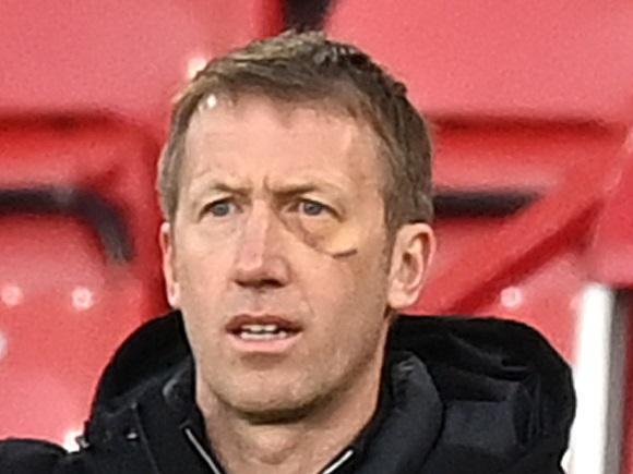 Finally we thought we'd have a quick check on the boss. Had three stitches and sustained a nasty black eye and whiplash after he fell and crashed into metal railings on Brighton beech. Looked a bit battered and bruised at Sheffield United but should look less like a boxer and more like a football manager in the dug out for Leeds.