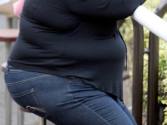 Obesity stock image