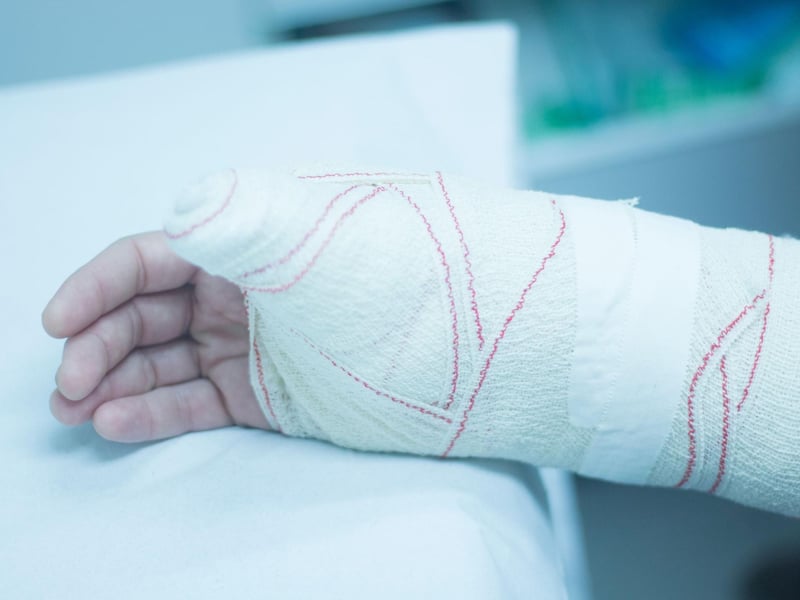Stookie. Meaning: A plaster cast for a broken bone. Example: "He’s got a stookie on after breaking his arm."