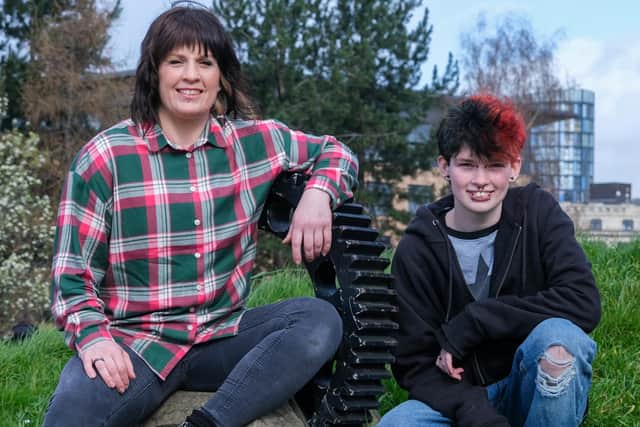 Kallvin said his mum Rachel has been 'very supportive', and is even fundraising to pay for his top surgery at a private clinic to avoid a six-year wait on the NHS.