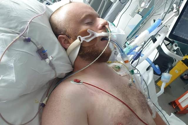 Doctors at the Royal Hallamshire Hospital, Sheffield, are operating after Branden Stromberg, from Clipstone, Nottinghmanshire, lost half his stull in a violent attack in the street. Picture: Branden StrombergSWNS