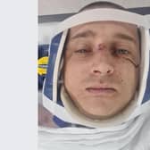 Dad of two Karlos Bingham suffered what have been described as life-changing injuries after he was involved in a crash near Aston, including spinal fractures, a broken shoulder blade and collarbone, a fractured rib as well as severe damage to the nerves connecting his spine to his left arm. He is pictured after the crash on the A57