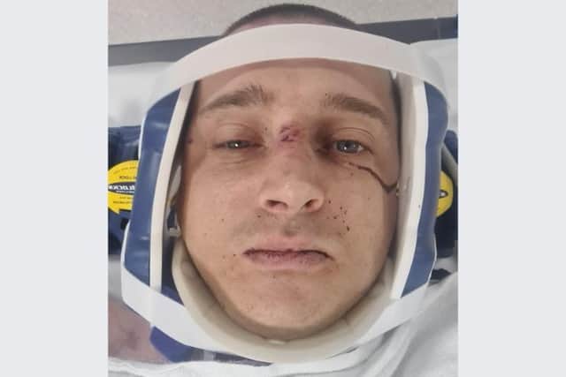 Dad of two Karlos Bingham suffered what have been described as life-changing injuries after he was involved in a crash near Aston, including spinal fractures, a broken shoulder blade and collarbone, a fractured rib as well as severe damage to the nerves connecting his spine to his left arm. He is pictured after the crash on the A57