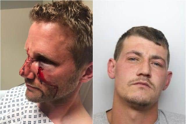 Adam Burgin (L) has been jailed over a horror attack on PC Dan Lumley, of South Yorkshire Police