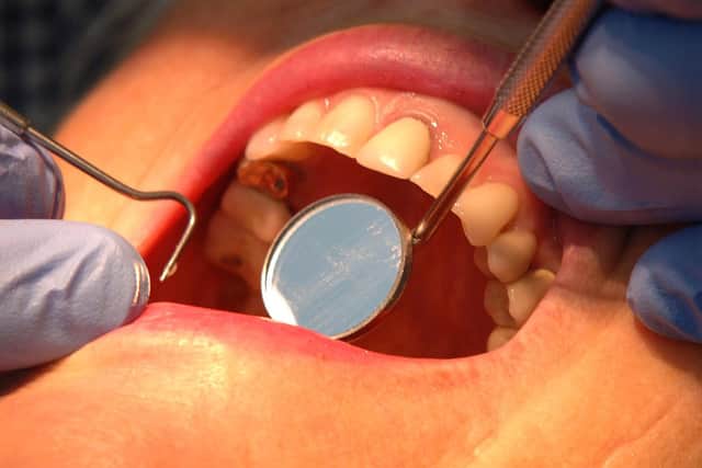 Around 620 in every 100,000 children in Sheffield underwent a tooth extraction as a result of decaying teeth last year