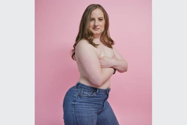 Sheffield woman Cassie D'Apice has posed for topless photos – five years after she was diagnosed with breast cancer.