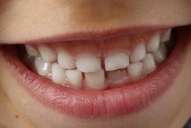 'Teggies' means teeth, normally belonging to a child.