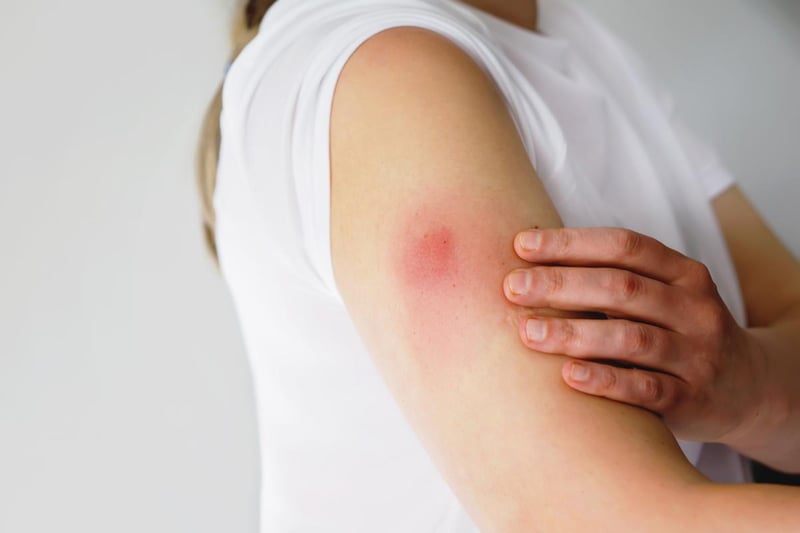 It is likely that you will notice some redness or bruising on your arm where the injection is given, but this should fade within a couple of days.