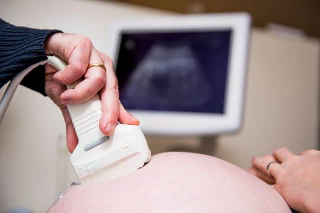 Stock image of an ultrasound examination (Photo credit should read JASPER JACOBS/AFP via Getty Images).