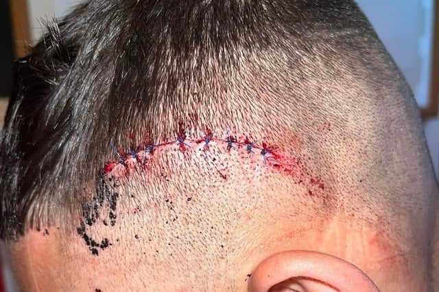 The mother of a young man who was slashed in the head with a machete as he tried to stop thieves targeting her van in Darnall, Sheffield, says he could easily have been killed in the attack