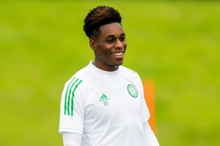 With a grin that wide, it's no wonder the Celtic wide man has a following the size of his smile on Twitter (50k) and Instagram (93k)
Twitter - @JeremieFrimpong
Instagram - @JeremieFrimpong22