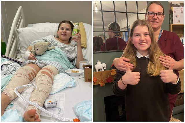 Freya Bedford, 12, suffered burns after an adult poured accelerant on a firepit at a friend's sleepover. Now she's on the road to recovery, her family are taking on a fundraising challenge to thank Sheffield's Children Hospital.