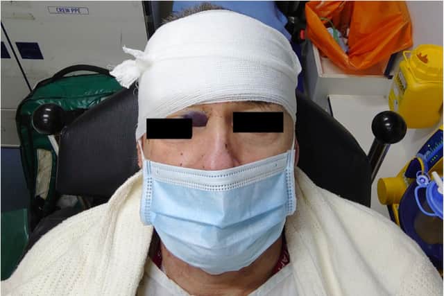 A cyclist who suffered a skull fracture in a crash in Sheffield is trying to trace two men who helped him at the scene