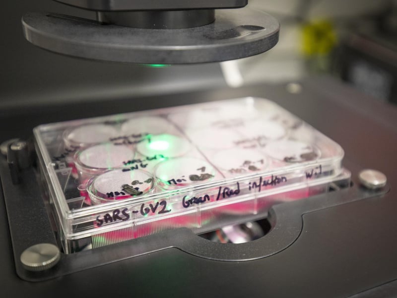 Plates that contain both non-infected and SARS-CoV-2 infected cells. These cultures are fluorescently tagged so they can be viewed and labelled easily in different colours on a fluorescent microscope