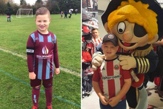 Cole Whitehead, who broke his leg in two places, pictured in his Clowne Comets kit and with Sheffield United mascot Captain Blade