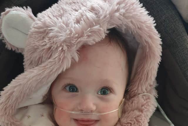 Jessica underwent two life-saving operations at Sheffield Children's