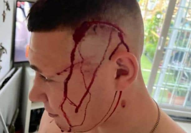 The aftermath of a machete attack carried out as the victim was trying to stop thieves stealing from his mother's van in Darnall, Sheffield