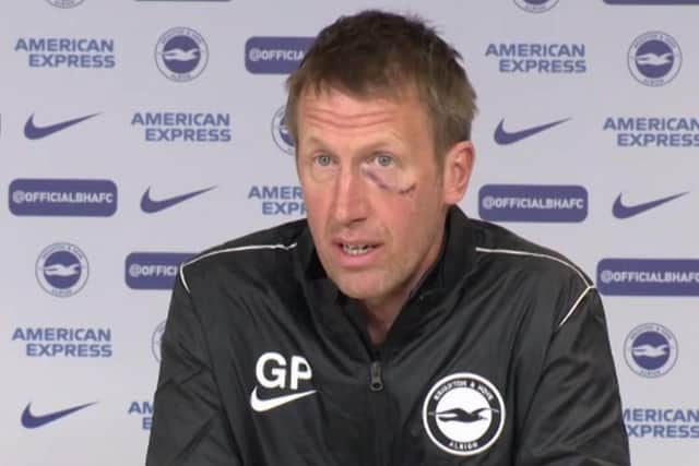 Graham Potter faced the media ahead of his side's clash with Sheffield United sporting a scar to his face: PA Video/PA Wire.