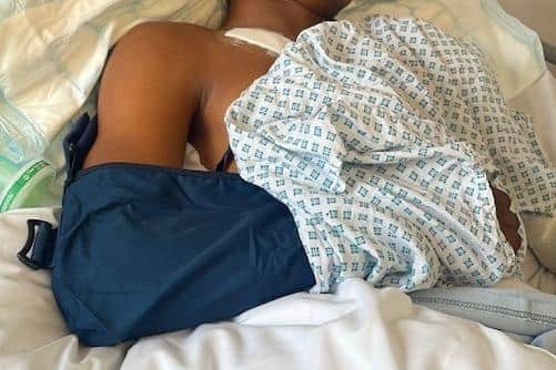 A photo of the injured teenager shared with The Star by the boy's mother. Her son was hospitalised following an incident at Forge Valley School.