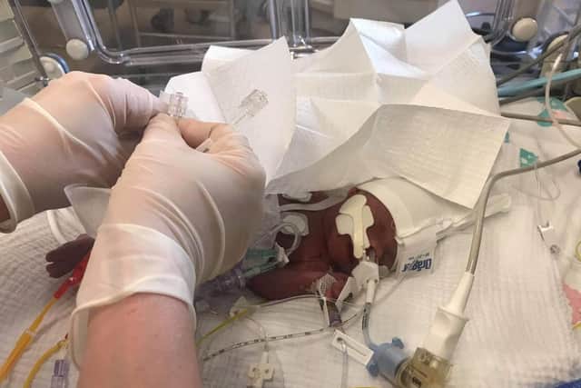 Louie Naylor was born 15 weeks premature and sadly passed away eight months later due to complications