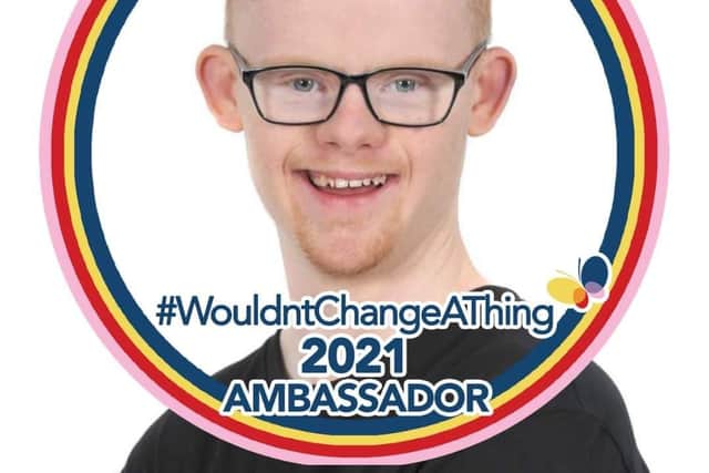 Liam is an ambassador for Wouldn’t Change A Thing, a charity which operates worldwide and seeks to make negative perceptions of Down Syndrome a thing of the past.