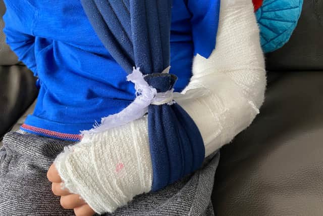 A boy, 4 suffered a broken arm after an accident at Gulliver's Valley Theme Park in Rotherham.