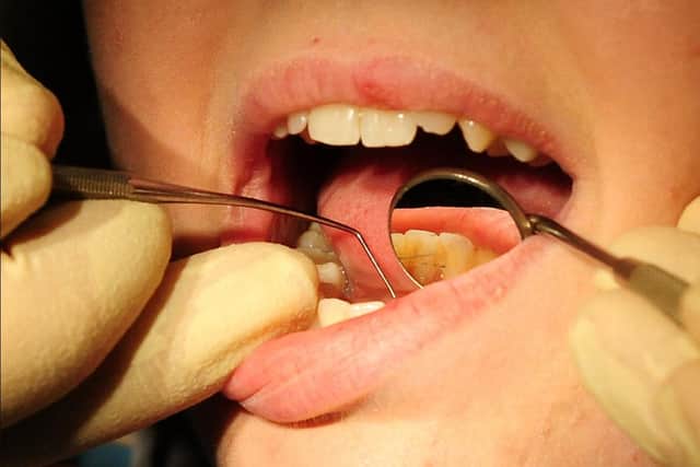 Patients have told Healthwatch Sheffield how much they are struggling trying to access NHS dental treatment