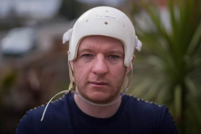 Branden Stromberg with the helmet he had to wear to shield his unprotected brain, as he lived in fear a single knock to the head could kill him. Picture: SWNS