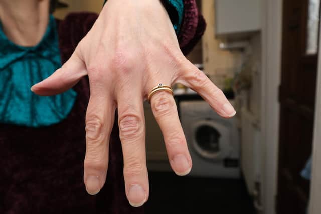 The ring ended up in the wash by accident during a hasty laundry load in 2018. BUt now it's back on Jane's hand.
