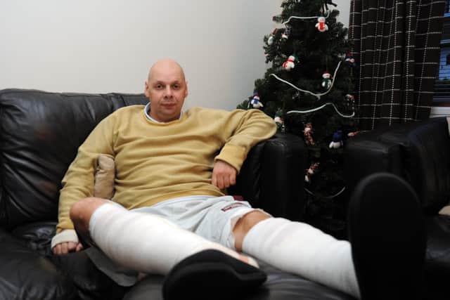 Postal Work Paul Coleman, pictured at Home in Richmond, Paul was Savaged by Two Dogs on his Postround, in Sheffield .
