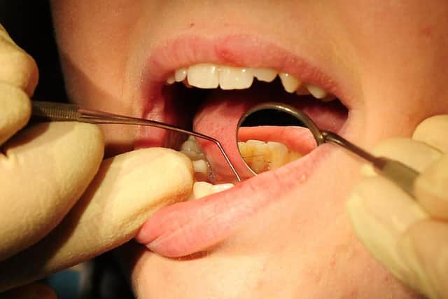 File photo of a general view of dentist at work. Picture: Rui Vieira/PA Wire