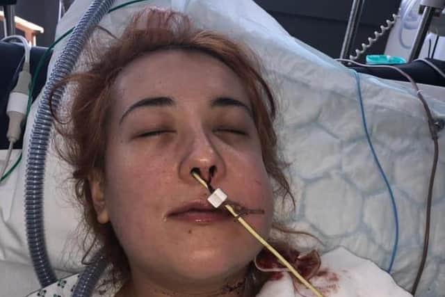 Jordan Del’Nero, from Westfield, Sheffield, in intensive care after undergoing surgery to remove a tumour. She has secured a settlement from Sheffield Teaching Hospitals after her 'urgent' case was classified as a new 'routine' appointment
