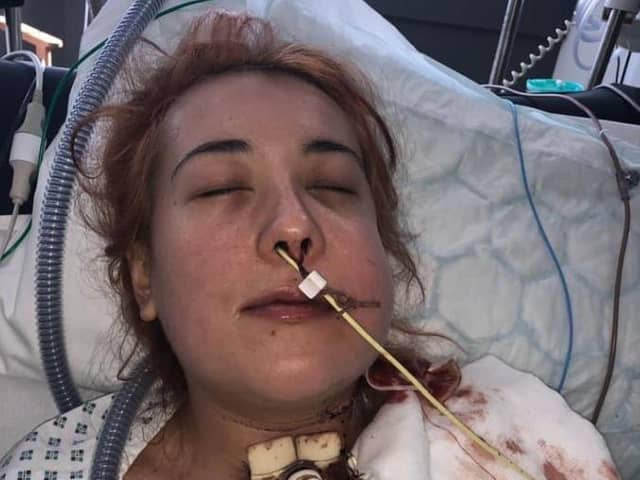 Jordan Del’Nero, from Westfield, Sheffield, in intensive care after undergoing surgery to remove a tumour. She has secured a settlement from Sheffield Teaching Hospitals after her 'urgent' case was classified as a new 'routine' appointment