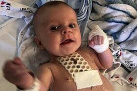 Paige's son Reuben had to undergo open heart surgery at just 3 months old.