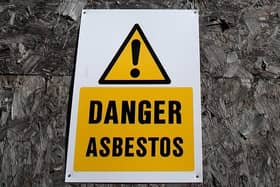 Exposure to asbestos can lead to mesothelioma, a type of cancer which affects the lining of some organs, including the lungs