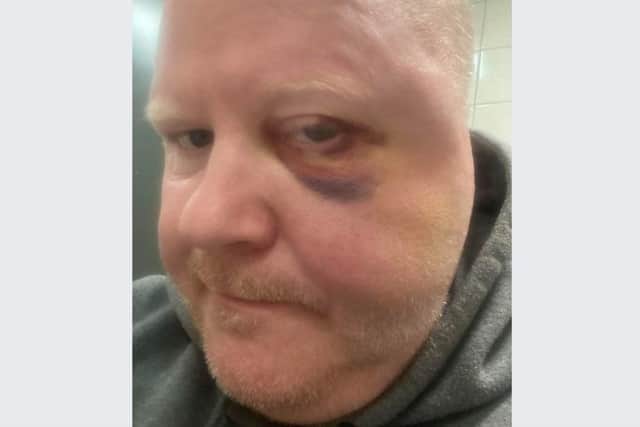 Police investigating an attack which left Sheffield former pool world champion Gary Swift, pictured, with a fractured skull say they have hit a dead end.