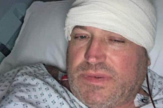 Doctors told Sheffield dad Dave Whitford he had an ear infection. But it turned out to be an inoperable brain tumour