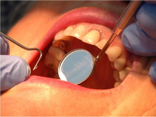 Dentists are struggling because of the coronavirus lockdown.