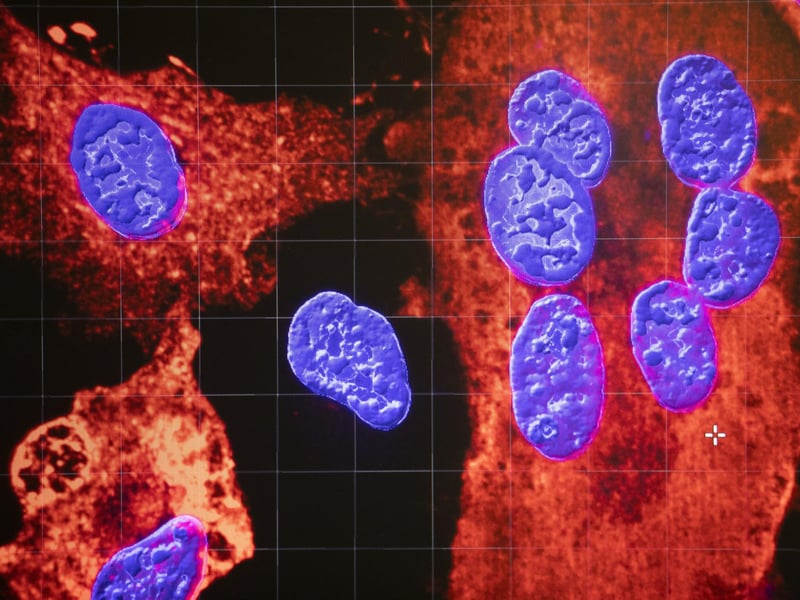 An image created with a confocal microscope shows cell nuclei (blue) being infected by SARS-CoV-2 (red areas), the virus which causes COVID-19