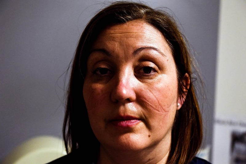 Heather Riddoch, Senior Charge Nurse ICU after less than two hours wearing facemask.