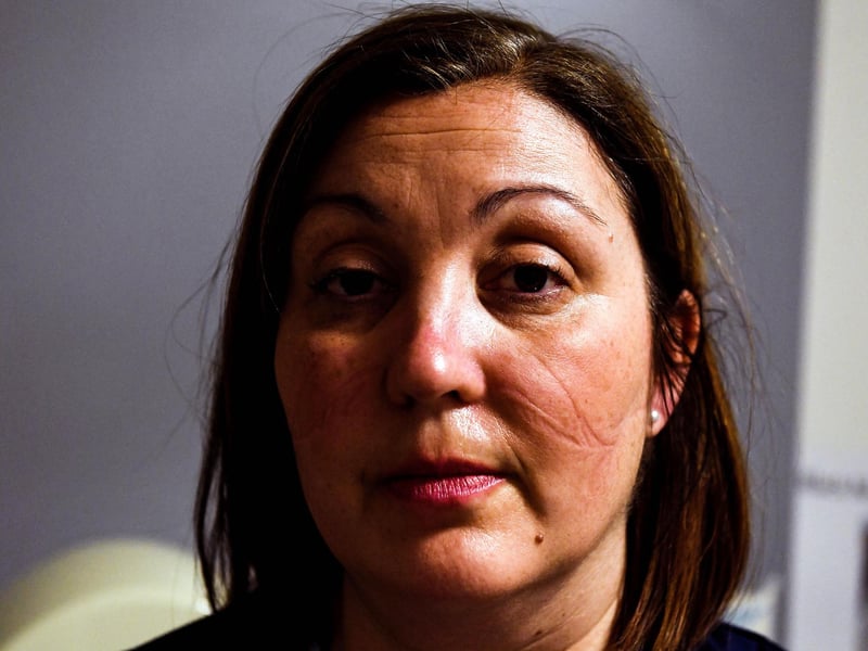 Heather Riddoch, Senior Charge Nurse ICU after less than two hours wearing facemask.