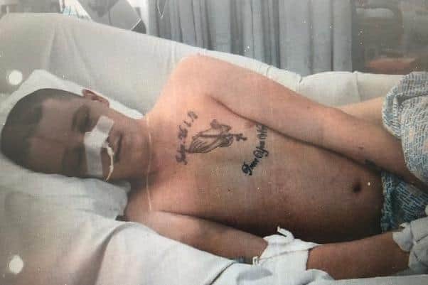 Pictured is Garon White, aged 26, of Southey Green, Sheffield, who has suffered a long and difficult recovery after a collision with a bus in Hillsborough, Sheffield. Picture courtesy of Irwin Mitchell solicitors.