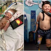 (Left) William was poorly in hospital for over three months (Right) Now he's learning to walk and smile again- pic by Dinky Feet.