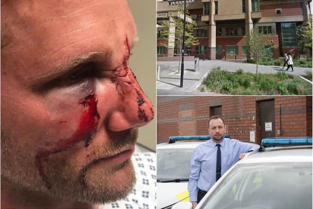 PC Dan Lumley was scarred for life after an attack in South Yorkshire