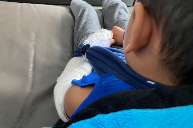 Nazeer said his 4-year-old nephew broke his arm after landing on metal railings that were placed so close to the bouncy castle.