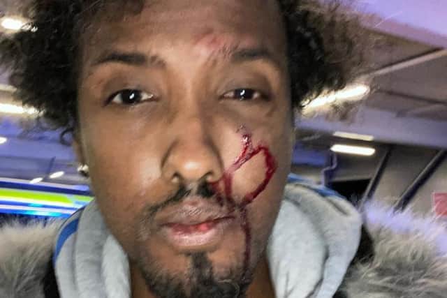 Musa Usuf was left with a bloody face after being stopped by armed police in Sheffield in a case of 'mistaken identity'