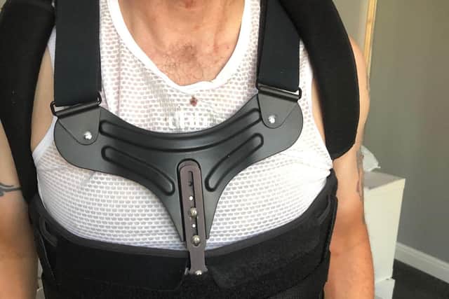 The spinal brace John must now wear for 12 weeks.