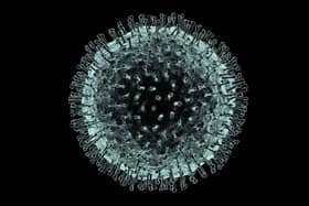 How coronavirus looks under a microscope (pic: Sunderland University)