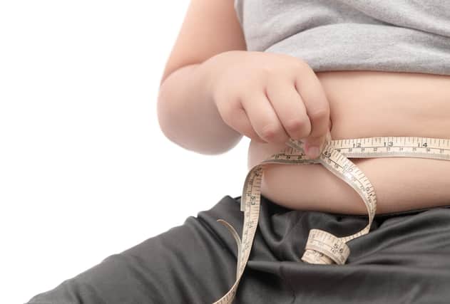 Obesity is a massive public health issue says Graham Moore
