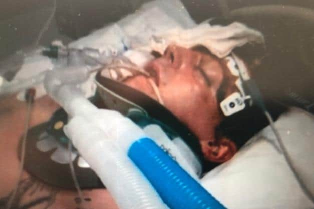 Pictured is father-of-four Garon White, aged 26, of Southey Green, Sheffield, after he suffered life-threatening injuries following a collision with a bus in Hillsborough, Sheffield. Picture courtesy of Irwin Mitchell solicitors.